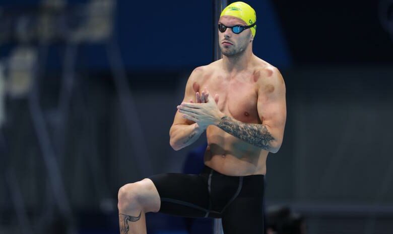 «علامات دائرية حمراء على الجلد».. العلاج بالحجامة يخطف الأضواء في أولمبياد طوكيو