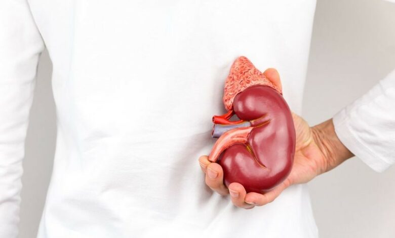 حصوات الكلى