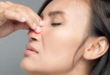 الجيوب الأنفية