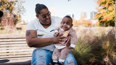 حالة استثنائية.. قصة نجاة أصغر طفل في العالم من الموت