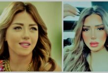 بعد فترة اختفاء.. هل خضعت سارة سلامة لعملية تجميل؟ (صور)