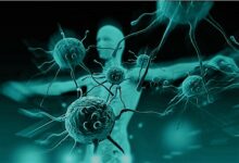 انتشار السرطان