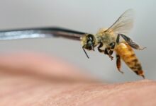 سرطان الثدي