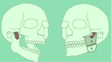 وسط دهشة العلماء.. اكتشاف عضلة جديدة بالفك