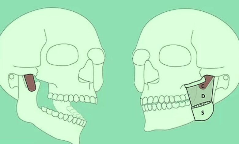 وسط دهشة العلماء.. اكتشاف عضلة جديدة بالفك