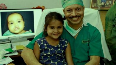 هذا الطبيب أجرى 37 ألف عملية مجانية للأطفال